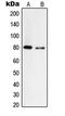 Tyrosinase antibody, LS-C352967, Lifespan Biosciences, Western Blot image 