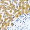 10-formyltetrahydrofolate dehydrogenase antibody, LS-C482764, Lifespan Biosciences, Immunohistochemistry paraffin image 