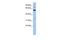 Malic Enzyme 1 antibody, PA5-40600, Invitrogen Antibodies, Western Blot image 