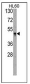 Histone Acetyltransferase 1 antibody, AP11103PU-N, Origene, Western Blot image 