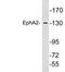 Ephrin type-A receptor 2 antibody, LS-C199848, Lifespan Biosciences, Western Blot image 