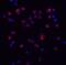 Interleukin 11 antibody, A01160-2, Boster Biological Technology, Immunofluorescence image 