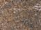 Hypoxia Inducible Factor 1 Subunit Alpha Inhibitor antibody, MBS2518178, MyBioSource, Immunohistochemistry paraffin image 