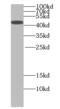 Tubulin Tyrosine Ligase antibody, FNab09096, FineTest, Western Blot image 