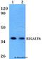 Beta-1,3-Galactosyltransferase 6 antibody, A11233, Boster Biological Technology, Western Blot image 