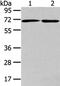 ADP Ribosylation Factor GTPase Activating Protein 2 antibody, PA5-51342, Invitrogen Antibodies, Western Blot image 