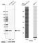 Interferon Induced Transmembrane Protein 3 antibody, NBP1-89401, Novus Biologicals, Western Blot image 