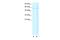 Cholinergic Receptor Nicotinic Alpha 2 Subunit antibody, A05586, Boster Biological Technology, Western Blot image 