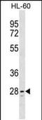 TLC Domain Containing 1 antibody, PA5-48778, Invitrogen Antibodies, Western Blot image 