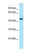 Nerve Growth Factor Receptor antibody, orb331221, Biorbyt, Western Blot image 