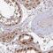Retinoblastoma-binding protein 5 antibody, PA5-63522, Invitrogen Antibodies, Immunohistochemistry frozen image 