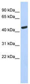 Tryptophanyl-TRNA Synthetase antibody, TA344288, Origene, Western Blot image 