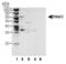 Serine/threonine-protein kinase PINK1, mitochondrial antibody, PA1-16604, Invitrogen Antibodies, Western Blot image 