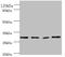 Matrix Metallopeptidase 7 antibody, A53820-100, Epigentek, Western Blot image 