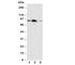 Amyloid-like protein 2 antibody, R30739, NSJ Bioreagents, Western Blot image 