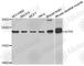Mitochondrially Encoded ATP Synthase Membrane Subunit 6 antibody, A8193, ABclonal Technology, Western Blot image 