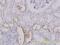 Solute Carrier Family 25 Member 11 antibody, H00008402-M01, Novus Biologicals, Immunohistochemistry paraffin image 