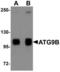 Autophagy Related 9B antibody, LS-B5275, Lifespan Biosciences, Western Blot image 