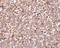 Phosphatidylinositol Glycan Anchor Biosynthesis Class Y antibody, 4945, ProSci, Immunohistochemistry paraffin image 