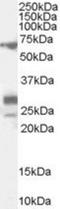 Spalt Like Transcription Factor 4 antibody, NB100-60559, Novus Biologicals, Western Blot image 