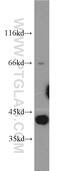 PARP2 antibody, 20555-1-AP, Proteintech Group, Western Blot image 