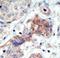 EPH Receptor B3 antibody, LS-C100285, Lifespan Biosciences, Immunohistochemistry paraffin image 