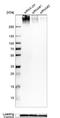 Lamin B Receptor antibody, NBP2-56993, Novus Biologicals, Western Blot image 