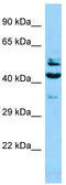 SH2 Domain Containing 4A antibody, TA331225, Origene, Western Blot image 