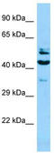 SH2 Domain Containing 4A antibody, TA331225, Origene, Western Blot image 