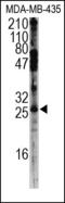 Snail Family Transcriptional Repressor 2 antibody, 200124, Abbiotec, Western Blot image 