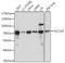 Solute Carrier Family 1 Member 3 antibody, A15722, ABclonal Technology, Western Blot image 