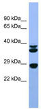 Fibroblast Growth Factor 3 antibody, TA346397, Origene, Western Blot image 