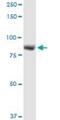Leucine Rich Repeat And Sterile Alpha Motif Containing 1 antibody, H00090678-D01P, Novus Biologicals, Western Blot image 