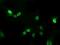 ALX Homeobox 4 antibody, NBP2-45490, Novus Biologicals, Immunocytochemistry image 