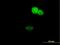 Zinc Finger Protein 124 antibody, H00007678-B01P, Novus Biologicals, Immunofluorescence image 