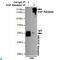 EGFR antibody, LS-C812958, Lifespan Biosciences, Immunoprecipitation image 