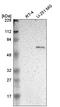 Asparagine synthetase [glutamine-hydrolyzing] antibody, HPA004924, Atlas Antibodies, Western Blot image 