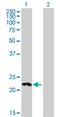 HECT Domain E3 Ubiquitin Protein Ligase 2 antibody, H00143279-B01P, Novus Biologicals, Western Blot image 