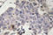 Signal Transducing Adaptor Molecule 2 antibody, LS-C176646, Lifespan Biosciences, Immunohistochemistry frozen image 