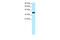 Nuclear Receptor Subfamily 4 Group A Member 1 antibody, 27-449, ProSci, Western Blot image 