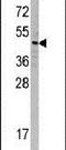 Sorting Nexin 6 antibody, PA5-11535, Invitrogen Antibodies, Western Blot image 