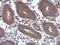 Serine/Threonine Kinase 16 antibody, PA5-28607, Invitrogen Antibodies, Immunohistochemistry frozen image 