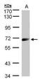 Interleukin 12 Receptor Subunit Beta 1 antibody, PA5-21527, Invitrogen Antibodies, Western Blot image 