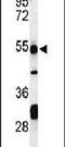 Prune Exopolyphosphatase 1 antibody, PA5-26752, Invitrogen Antibodies, Western Blot image 