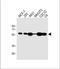 SRC Proto-Oncogene, Non-Receptor Tyrosine Kinase antibody, M00107-4, Boster Biological Technology, Western Blot image 
