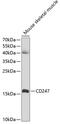 CD247 Molecule antibody, GTX53919, GeneTex, Western Blot image 