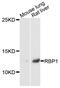 Retinol Binding Protein 1 antibody, abx135947, Abbexa, Western Blot image 
