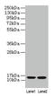 Beta-2-Microglobulin antibody, CSB-PA002486YA01HU, Cusabio, Western Blot image 