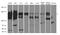 Protein Phosphatase 6 Regulatory Subunit 2 antibody, A12592-1, Boster Biological Technology, Western Blot image 