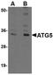 Autophagy Related 5 antibody, PA5-20688, Invitrogen Antibodies, Western Blot image 